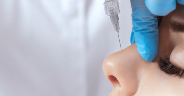 Non-Surgical Rhinoplasty Explained: Benefits and FAQs